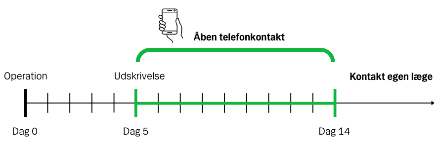 Eksempel på åben telefonkontakt. iguren viser perioden for Åben telefonkontakt. De 14 dages åben telefonkontakt gælder fra operationsdagen. I eksemplet bliver patienten udskrevet på dag 5 efter operationen og kan kontakte os frem til dag 14 efter operationen. 
