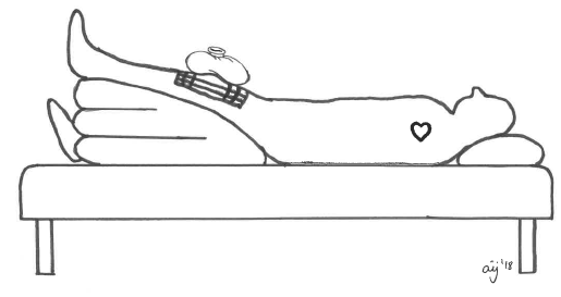 En tegning af en person, der ligger i en seng med en ispose på knæet.