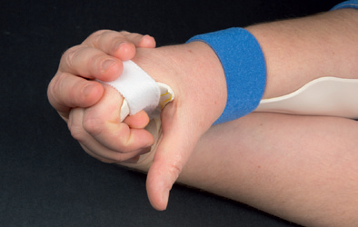 Billedet viser, at man med den raske hånd holder den skadede hånds fingre mod skinnen.