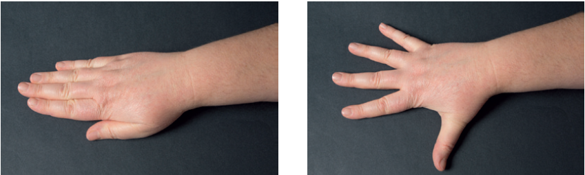 Billedet viser en hånd med strakte fingre og en hånd med spredte fingre.