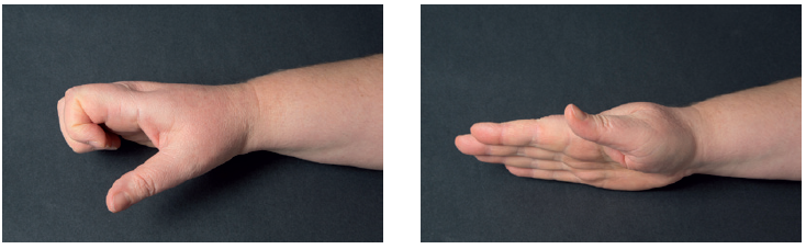 Billedet viser en hånd, hvor fingrene er bøjede og et billede af en strakt hånd.