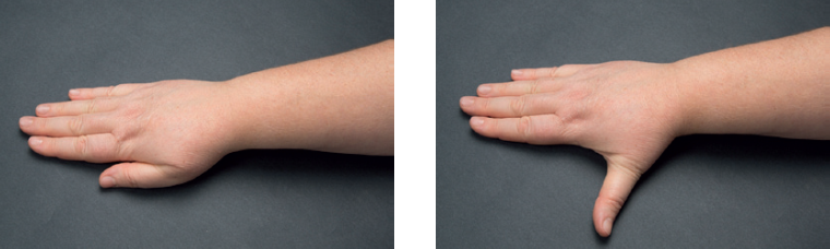 Venstre billede viser, at man skal placere hånden fladt. Højre billede viser, at man nu skal føre tommelfingeren væk fra de øvrige fingre.