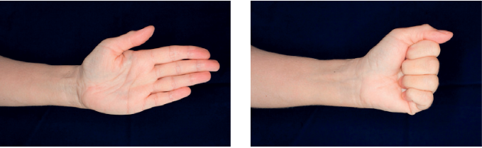 Venstre billede viser en åben hånd. Højre billede viser en hånd foldet sammen til en knytnæve.