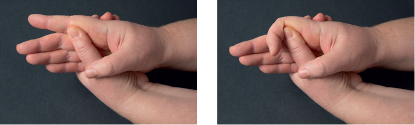 Venstre billede viser, at man med den raske hånd skal holde om fingeren ved mellemledet. Højre billede viser at den finger der bliver støttet, skal bøjes.