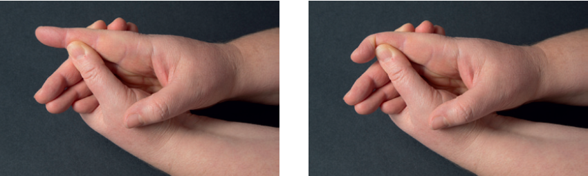 Venstre billede viser, at man med den raske hånd holder omkring fingeren, som er strakt. Højre billede viser at man nu skal bøje fingeren.