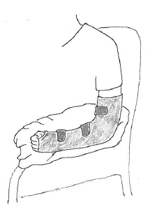 Billedet viser, at man sidder ned, og har en pude under armen i bandage.