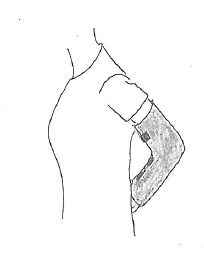 Billedet viser, at man fører armen i bandage om til lænden.