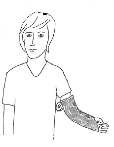 Billedet viser, at man har placeret en sammenrullet klud mellem krop og overarm til armen i bandagen.