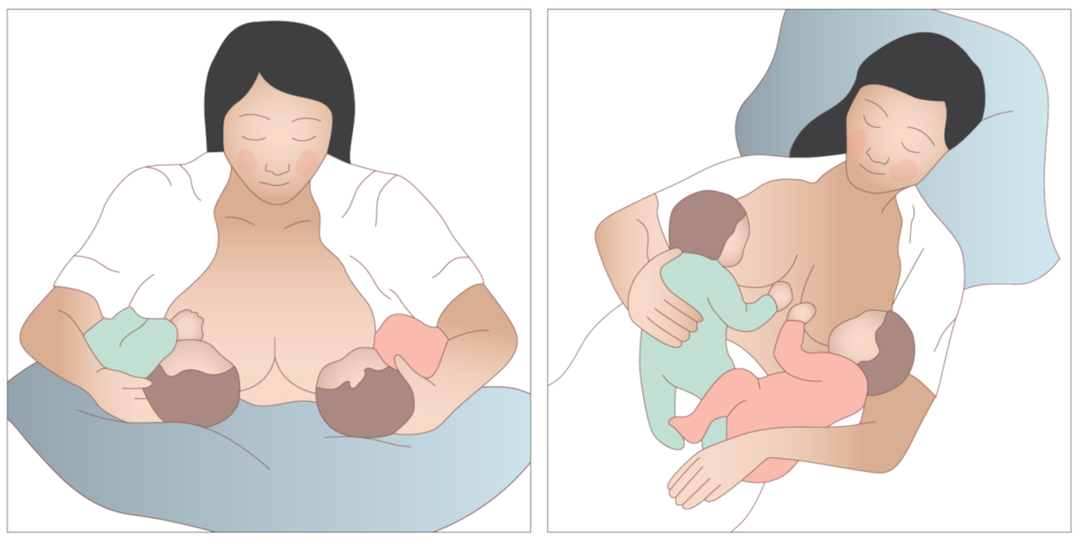 Illustration af ammeteknik med tvillinger.