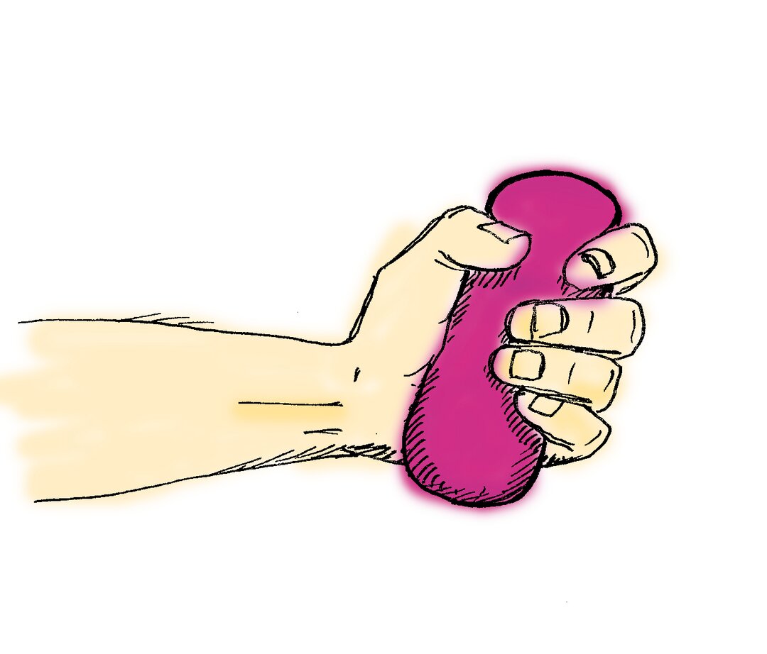 På tegning ses hvordan man kan træne armen, ved at trykke på en træningspude, efter anlæggelse af AV-filsten. 