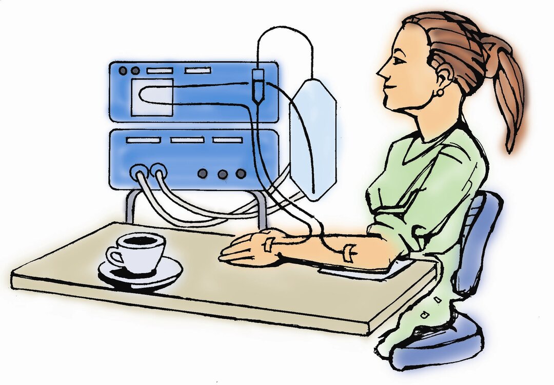 På tegningen ses en kvinde siddende ved bord, med en kop kafffe, med et dialyse dop i armen.