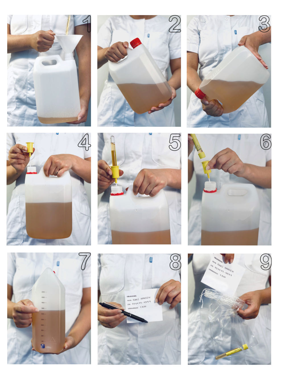 Billedet viser, fremgangsmåden ved opsamling af urinen.