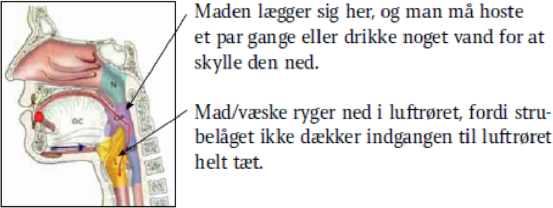En illustration af, hvordan to problemer gør, at den normale synkning er svær.