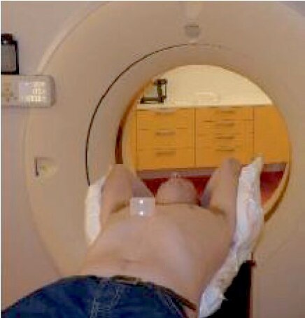 Et billede af en patient til CT- scanning