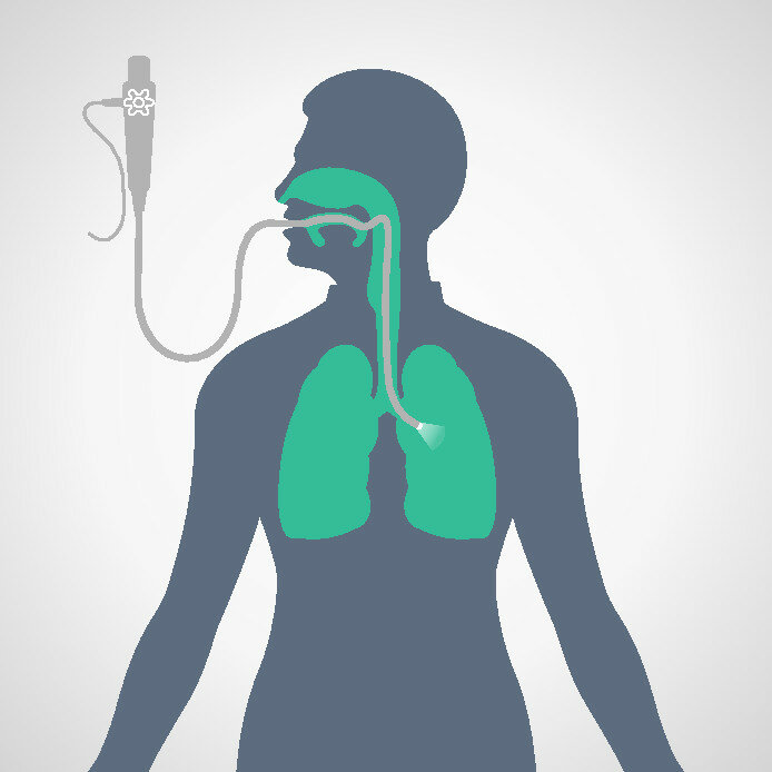 Billedet viser en illustration af kikkertundersøgelsen af lungerne.