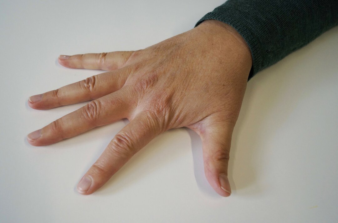 Billede af fingerøvelse