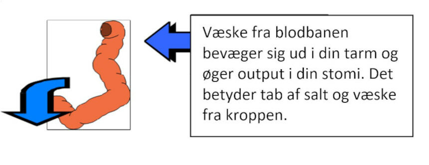 Figur, som viser hvilken effekt væske med et lavt indhold af salt har på tarmen
