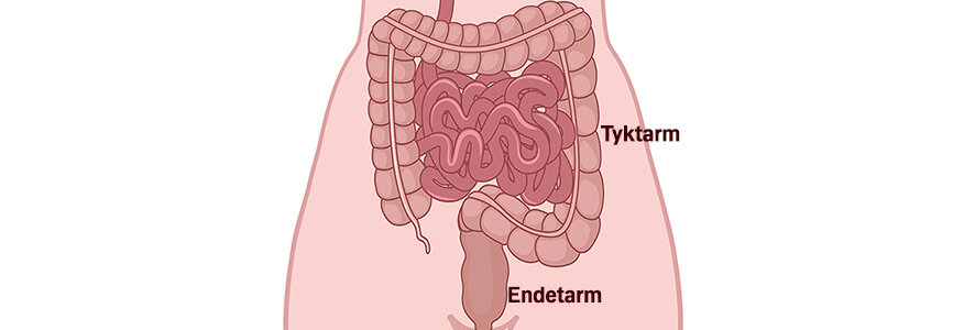 Illustrationen viser at endetarmen kommer i forlængelse af endetarmen.