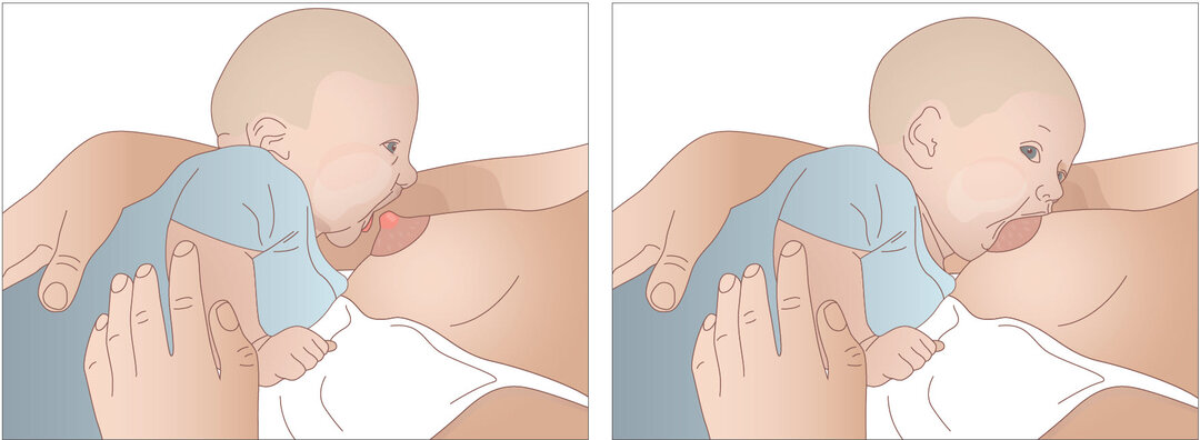 Illustration af barnets sutteteknik.