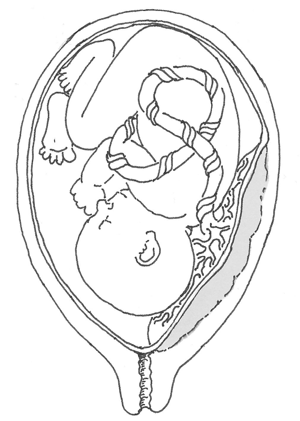 Low-lying placenta Illustration by Randi Iversen