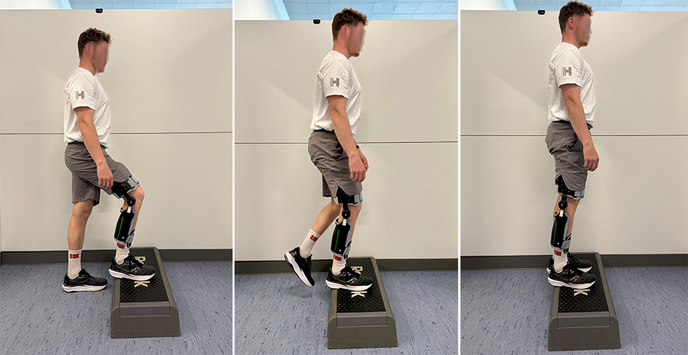 Step up på lavt trin, VMO-aktivering