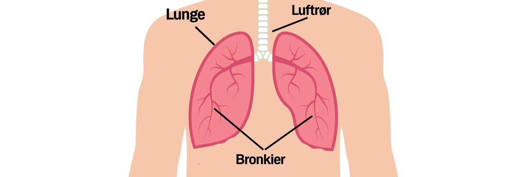 patologisk tårn Hængsel Astmatisk bronkitis og astma