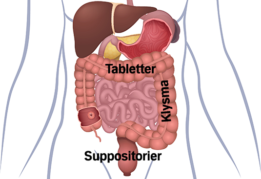 Illustrationen viser af tabletter og klysma sidder i tyktarmen og suppositorier sidder ved endetarmen.