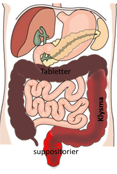 Illustrationen viser tarmsystemet samt forskellige behandlinger.
