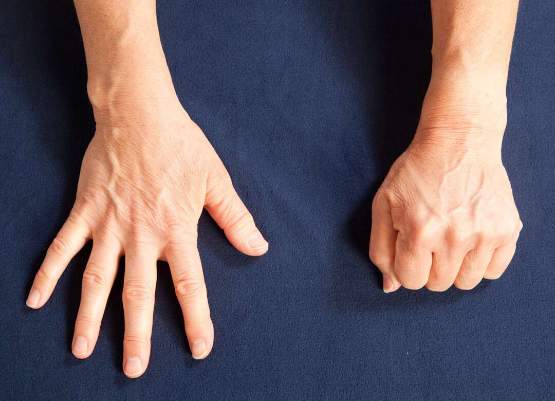 Øvelse 2 - Knyt og stræk hånden  Sid med ret ryg og sænkede skuldre. Skift mellem at knytte hånden og strække fingrene.  Udfør helst øvelsen en gang i timen.