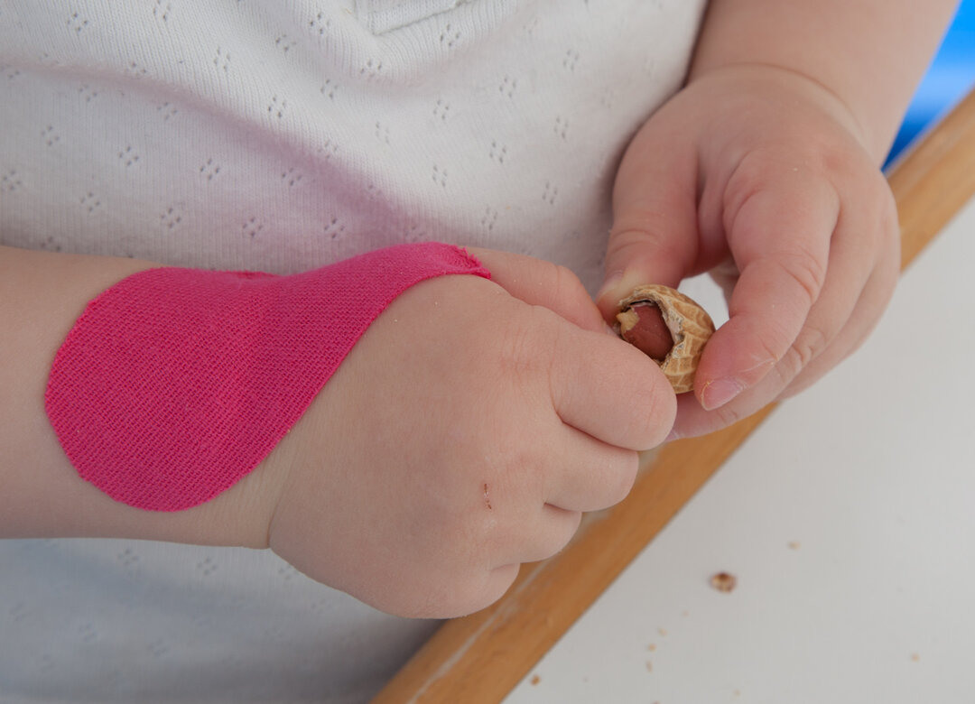Billedet viser et barn med tape på hånden, åbne en jordnød.