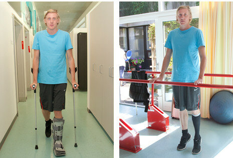 Billedet viser en patient med krykker og walkerstøvle