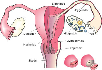 Billedet viser en tegning af en livmoder. 