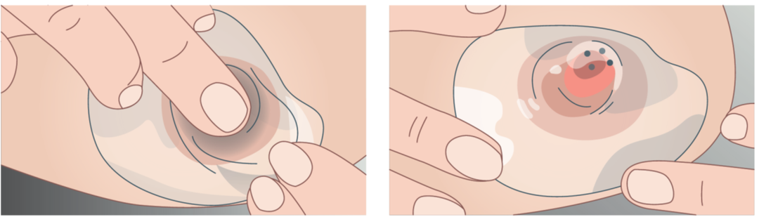 Illustration af, hvordan suttebrikken påføres.