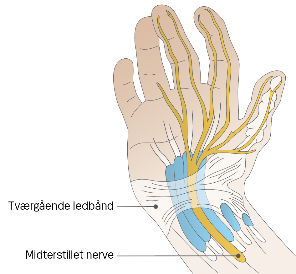 Illustration af hånd