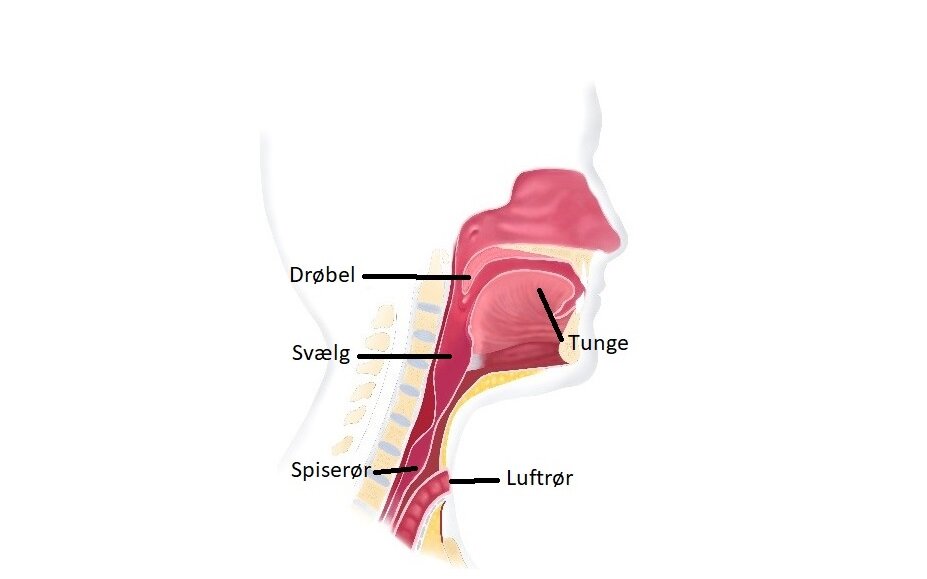 Billeder viser hals og mund efter operation, hvor strubelåg og stemmelæber er væk