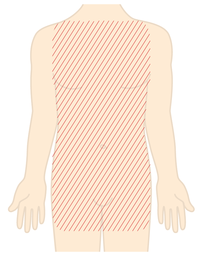 Illustration af, hvor på kroppen, du bliver barberet