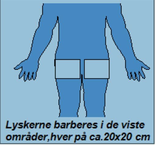 Barbering af lysker
