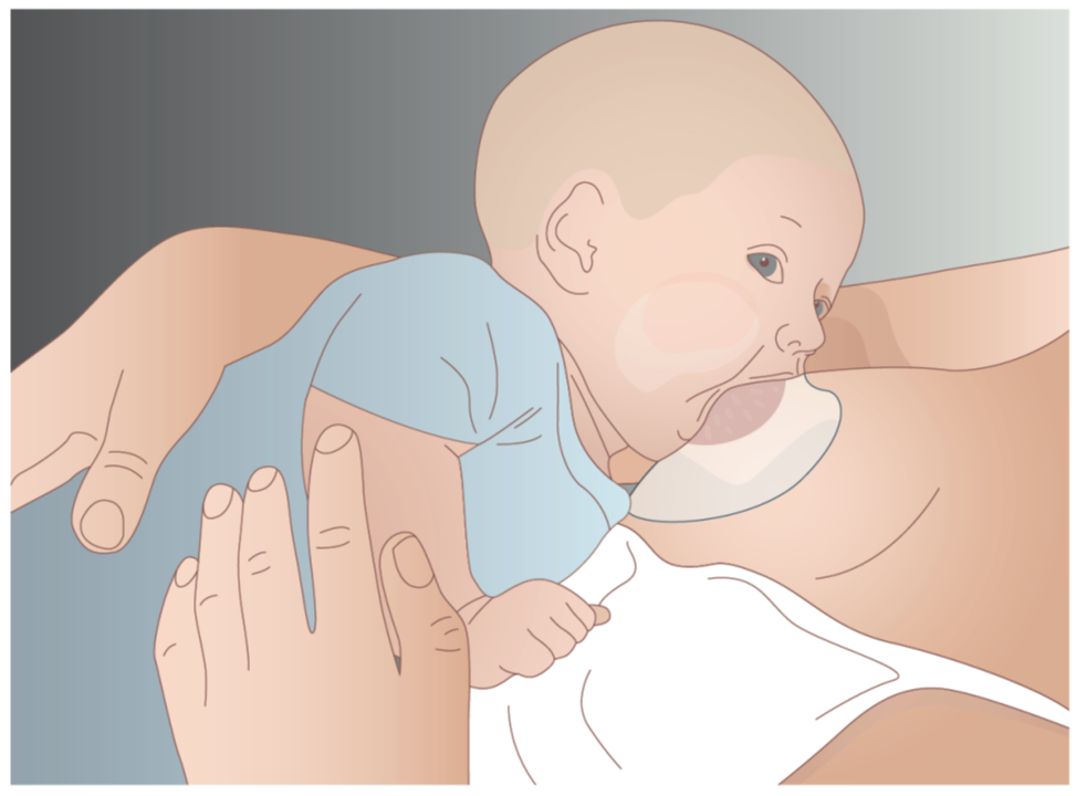 Illustration af barn, der ammer med sugebrik.