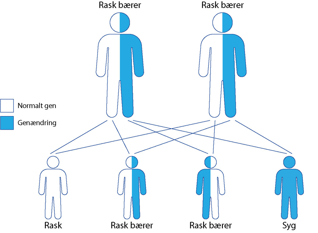 Illustation af hvordan generne gives videre til børn, når begge forældre er raske bærer af et gen.