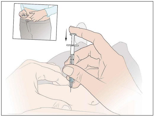 Illustrerer hvordan injektionen gives i maveskindet. 