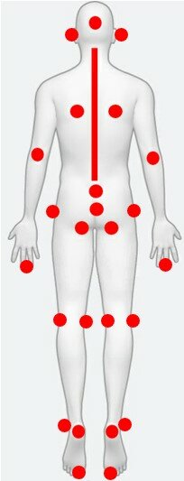 Figur, der viser de trykudsatte steder på kroppen
