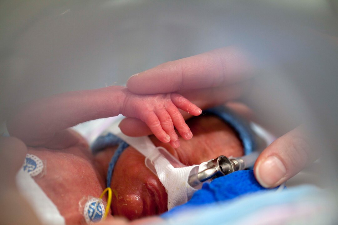 Billede af en præmatur baby i CPAP-maskine