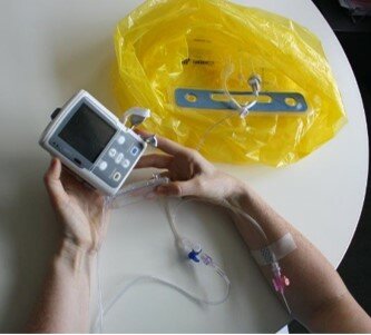 Billede af pumpe samt den gule pose med infusionsslagen i